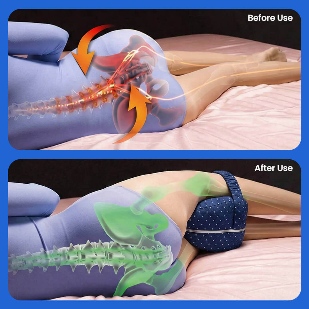 AlignRest™ Premium Orthopaedic Leg Pillow